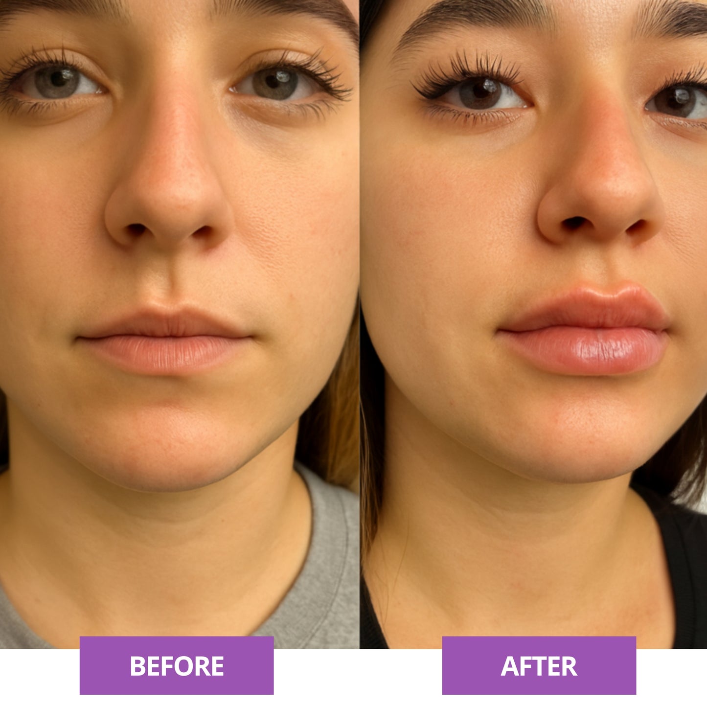 Lip Plump Serum